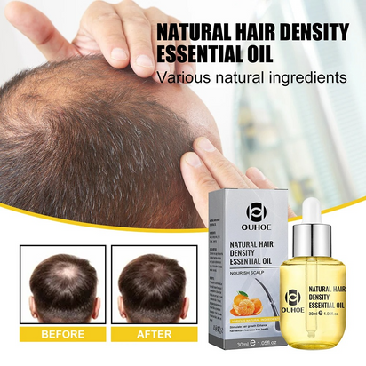 Natural Hair Growth Essential Oil