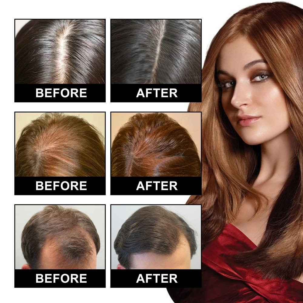 Natural Hair Growth Essential Oil